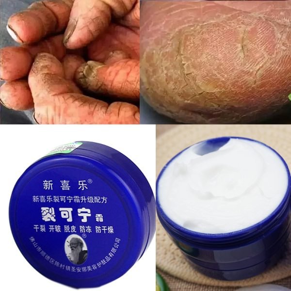 Anti Drying Crack Foot Cream